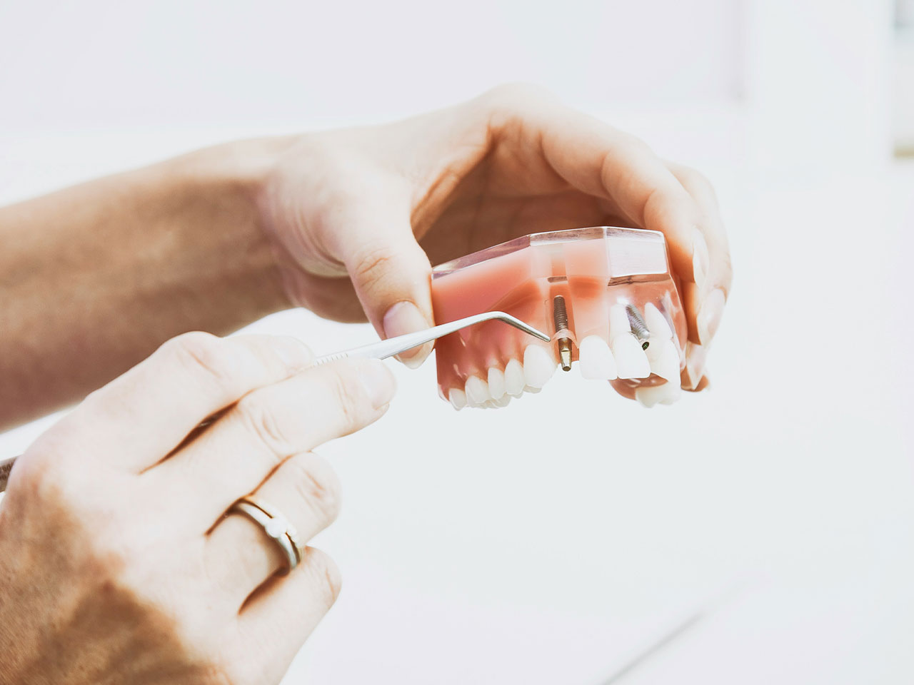 Implant